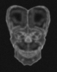 Frontal X-ray EU/OS.018 University of Emmetsburg, 1995.