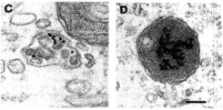 Skin cells