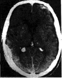 Nanbrain.jpg